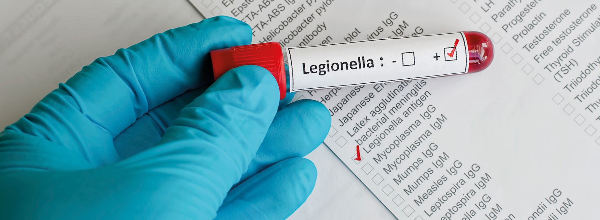Control de Legionela