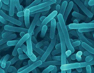 ¿Los brotes de listeria son una causa importante de alarma?